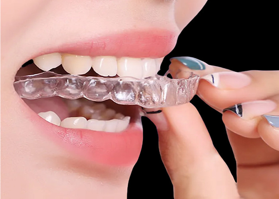 Goede prijs Onzichtbare retainer Orthodontische apparaten voor snelle en effectieve behandeling online