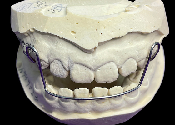 Goede prijs Gids Arch Appliance Orthodontic Retainers Aligners met goede retentie Bewezen gemak online