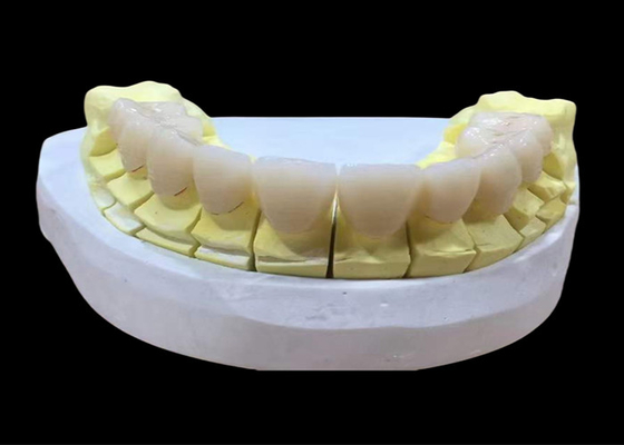 Goede prijs Zirconia porselein tandheelkundige kroon met esthetische en natuurlijke afwerking uit China tandheelkundig laboratorium online