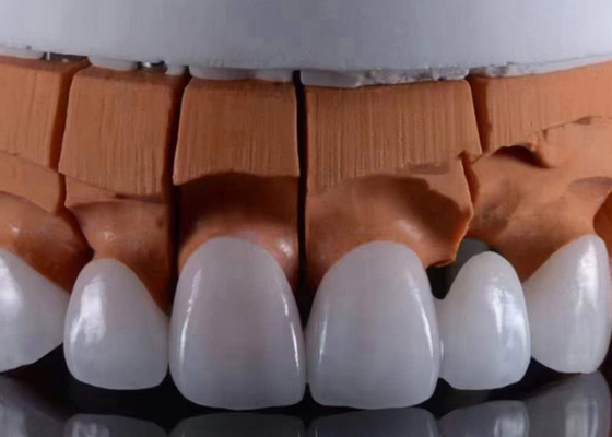 Goede prijs FDA goedgekeurd Translucent Zirconia tandkronen Precise fit met natuurlijke esthetische uitstraling online