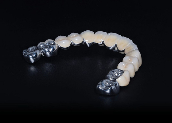 Goede prijs Hoge duurzaamheid Biocompatibel porselein gesmolten met metalen kroon Precise fit Custom online