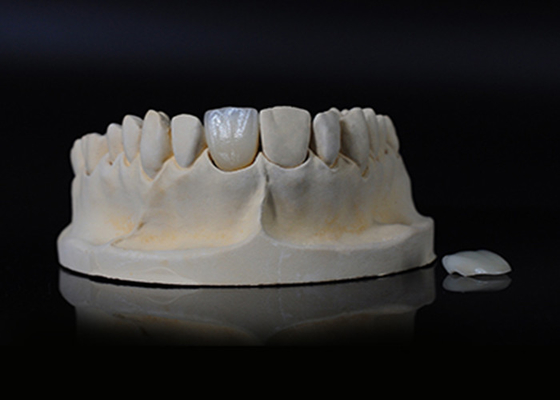 Goede prijs Translucent porselein Emax fineer voor uitstekende pasvorm / natuurlijke esthetiek online