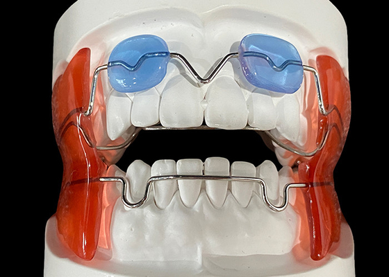 Goede prijs Frankel 2/3 orthodontische apparaat, verbetert de kaak uitlijning bij groeiende kinderen online