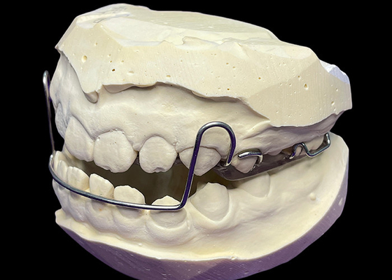 Goede prijs Guidewire orthodontisch apparaat voor nauwkeurige tandbeweging en -uitlijning online