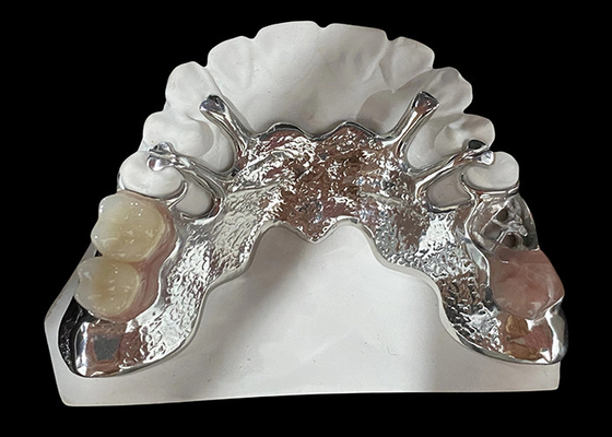 Goede prijs Aanpasbaar giet gedeeltelijk verwijderbare tandheelkunde met acrylhars / metalen basis ontwerp online
