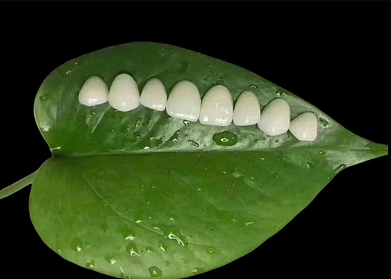 Goede prijs Minimale voorbereiding Porselein EMAX veneer voor cosmetische tandheelkundige behandeling online