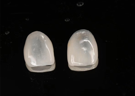 Goede prijs Esthetische restauratie Emax keramische fineer Translucentie met gepolijst oppervlak online