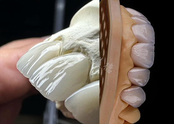 Goede prijs Langdurig tandheelkundig, solide circonia kroon, precieze kroon tanden circonia tandheelkundig laboratorium. online