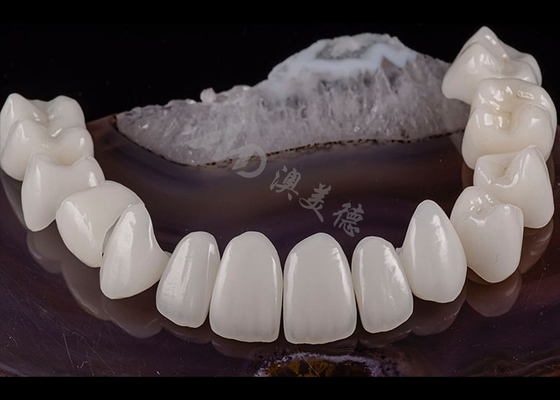 Goede prijs Translucent tandheelkundige tand Solid Zirconia kroon Natuurlijke esthetiek Scheurweerstand online