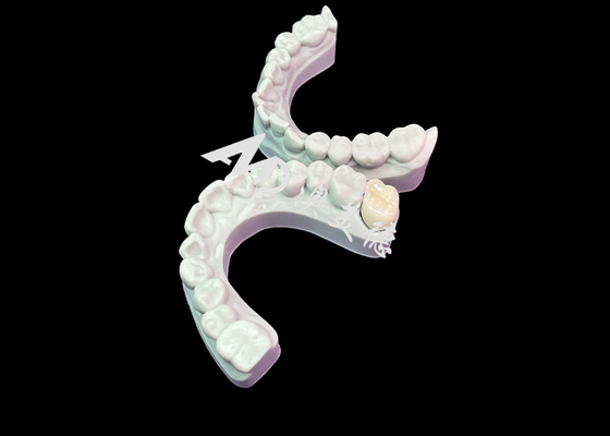 Goede prijs Precise Fit Zirconia Tandkronen Esthetische natuurlijke kleur Uitstekende biocompatibiliteit online