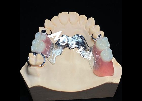 Goede prijs Afneembare tandheelkunde met gegoten metalen frame voor superieure sterkte en stabiliteit met langdurig comfort online