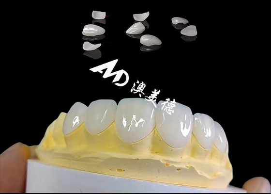 Goede prijs Transluccency IPS Emax veneers, minimale voorbereiding Emax tandheelkundige veneers online