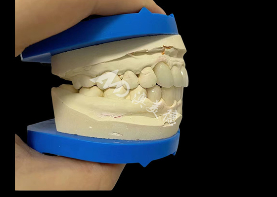 Goede prijs Onverslaanbare sterkte tandheelkundige circone Dentla kroon voor een natuurlijke glimlach online
