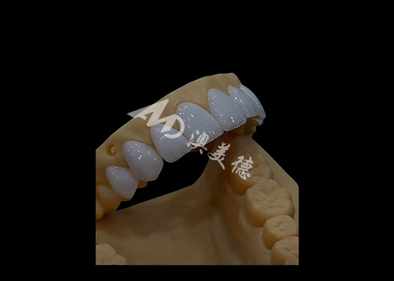 Goede prijs Prothese Tandheelkunde Zirconia Tandheelkundige kroon Precise Fit Aesthetics Voor volle boog tanden online