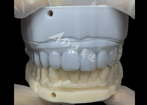 Goede prijs Orthodontische retainer Essix Retainer Eenvoudige en veelzijdige correctie online
