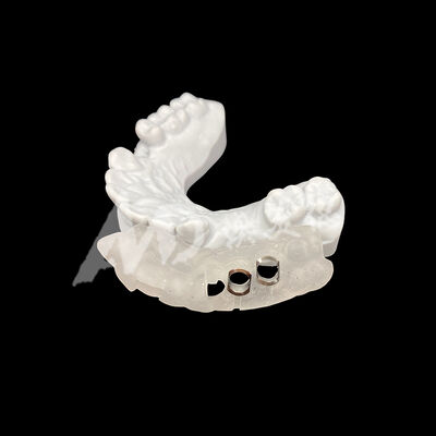 Goede prijs Precise Fit 3D Printed Surgical Implant Guide met hoge weerstand tegen verkleuring met behulp van CAD/CAM-freestechnologie online