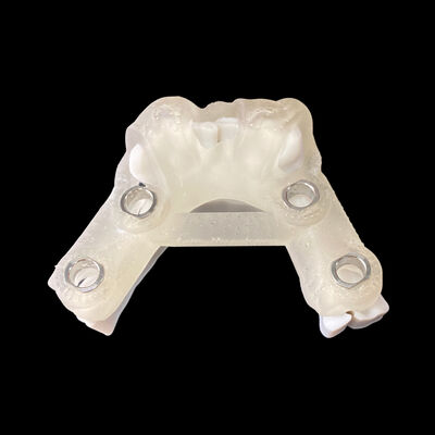 Goede prijs Digitale chirurgische gids voor implantaten met planverslag voor implantaten online