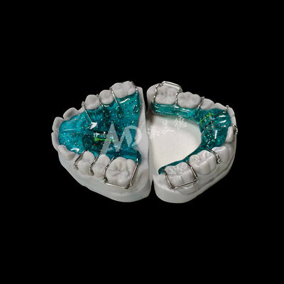 Goede prijs Verstelbare Expander Orthodontische Apparaten Op Maat Gemaakte Uitneembare Apparaten Bieden Comfortabele Oplossingen voor Tandcorrectie Online